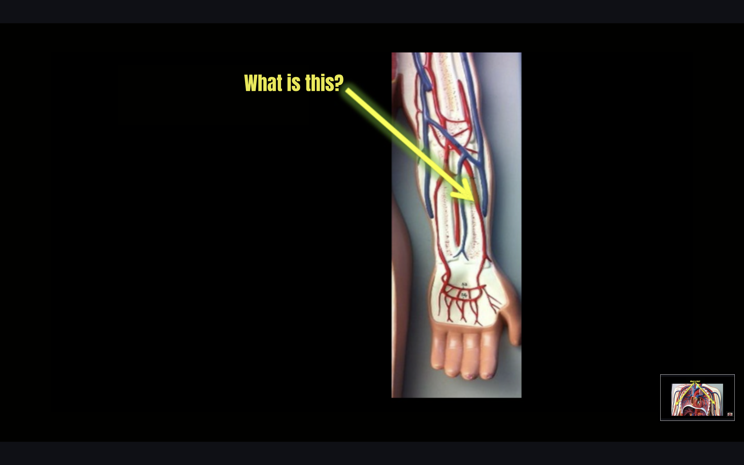 term image