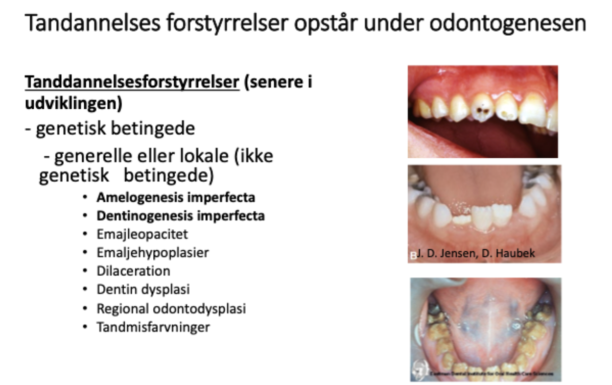 <p>Amelogenesis imperfecta (ufuldstændig emalje, stor grad)</p><p>Dentinogenesis imperfecta (ufuldstændig dentin, ravfarvet og korte rødder)</p><p>Emaljeopacitet: hvide/opake pletter i emaljen, Ved opasiteter vil der ikke fra starten af være brud på emaljeoverfladen, som ved emaljehyperplasi</p><p>Emaljehypoplasier: Ikke det samme som opasiteter, da der ved emalje hypoplasier er emaljen der ikke fra starten af</p><ul><li><p>Turnertand: Kommer efter et traume eller betændelsestilstand på primærtand.</p><ul><li><p>Påvirker permanent tand.</p></li><li><p>Kan sidde forskellige steder på tandkronerne.</p></li></ul></li></ul><p>Dilaceration: tanddeformitet grundet traume (krone eller rod)</p><p>Dentin dysplasi: type 1=korte rødder, type 2=stor pulpakammer</p><p>odontogenesis imperfecta (rammer emalje og dentin)</p><p>regional odontodysplasi: spøgelseslignende tænder på rtg. (lokaliseret/ikke arvelig abnormitet af emalje, dentin, pulpa)</p><p>Tandmisfarvninger:</p><ul><li><p>tetracyklin: grållig/lilla farve</p></li></ul><p>Dental fluorose: horisontale linjer</p><p>Stråleterapi: under tanddannelsen kan give aplasi, mikrodonti, korte rødder, emaljehypoplasi. </p><p>D-vitamin mangel: klinisk ses forsinket tandfrembrud og emaljehypoplasi. Rakitis</p>