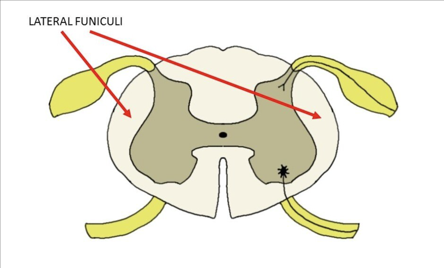 <p>LATERAL FUNICULUS’ function SENSORY, MIXED or MOTOR?</p>