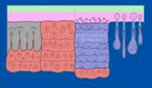 <p>strike extensive aprons </p><p>discontinuous geobodies</p>