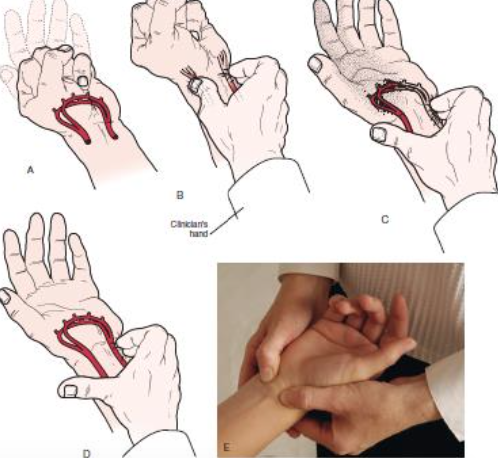 <ul><li><p><span>PURPOSE- To identify vascular compromise</span></p></li><li><p><span>DESCRIPTION- The patient is asked to open and close the hand several times as quickly as possible and then squeeze the hand tightly. The examiner’s thumb and index finger are placed over the radial and ulnar arteries, compressing them. The patient then opens the hand while pressure is maintained over the arteries. One artery is tested by releasing the pressure over that artery to see if the hand flushes. The other artery is then tested in a similar fashion.</span></p></li></ul><p></p>