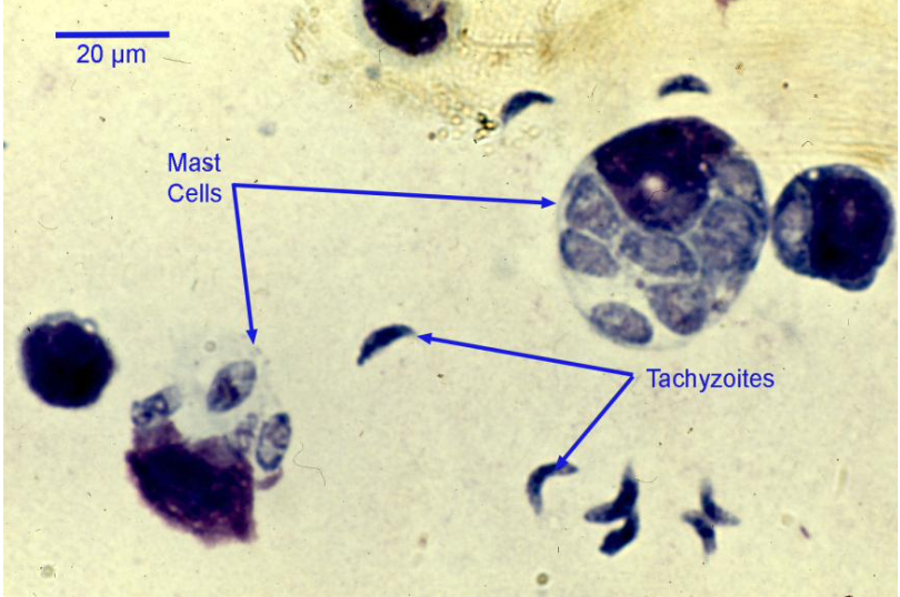 <p>what stage of toxoplasma gondii is shown?</p>