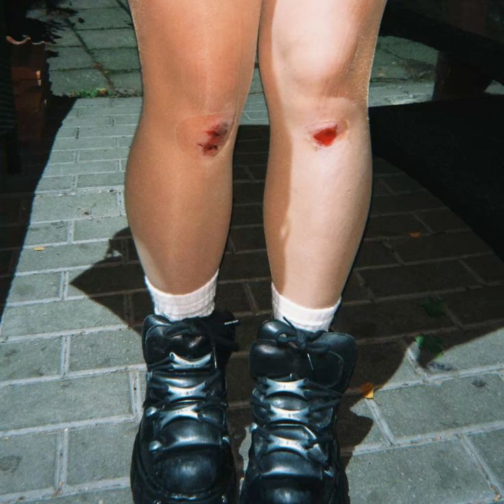 <p>to slightly damage your skin by rubbing it against something rough</p><p></p><p><strong>Common collocations</strong></p><ul><li><p>___ your knee</p></li><li><p>___ your hand</p></li><li><p>badly ___</p></li></ul><p></p><p><em>He ____ his knee.</em></p><p><span><em>He ___ his elbow on a sharp piece of rock.</em></span></p>