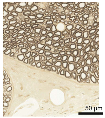 <p>A25) Below is a preparation that is stained with Osmium. Name the cell type that forms the dark brown "circular" structures in the upper part of the image.</p>