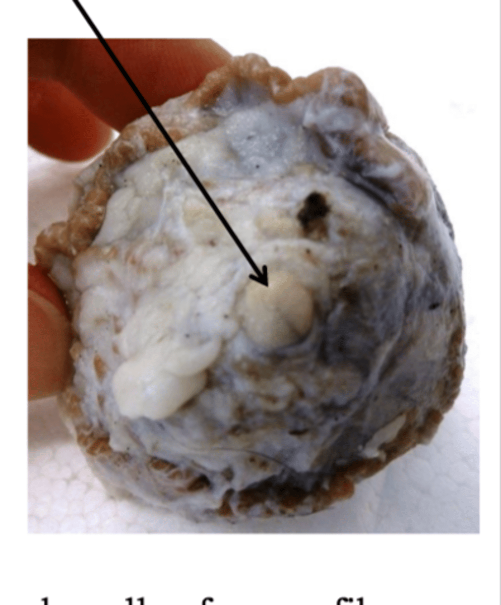 <p>-posterior of eyeball</p><p>-innervates eye</p><p>-originates from retina</p><p>-passes through optic canal</p>