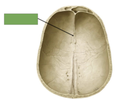 <p>This is the (calvaria view)</p>