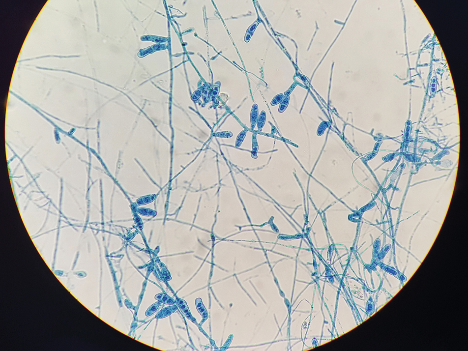<p>Identify this fungus</p>