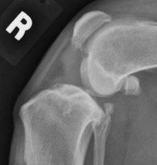 <p>What is your diagnosis?</p>
