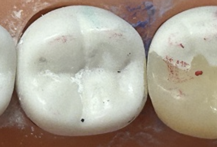 <p>Identify (2) errors with this restoration</p>