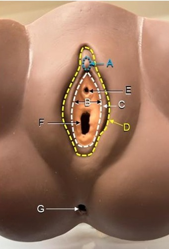 <p>A</p>