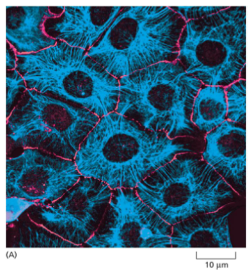 <p>Intermediate filaments (IF) Properties</p>