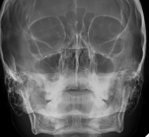 <p><span style="background-color: transparent;">&nbsp;Facial - WATERS</span></p>