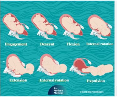 <p>1. Engagement</p><p>2. Descent</p><p>3. Flexion</p><p>4. Internal rotation</p><p>5. Extension</p><p>6. External rotation (also called Restitution)</p><p>7. Expulsion</p>