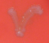 <p>A(n) ________ hemolysis test shows <strong>no </strong>breakdown of red blood cells. </p>