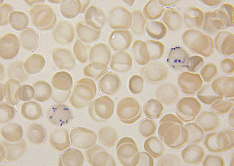 <p>This image represents a field of RBCs stained with a supravital stain. How would these cells look if viewed on a Wright-stained smear?</p>