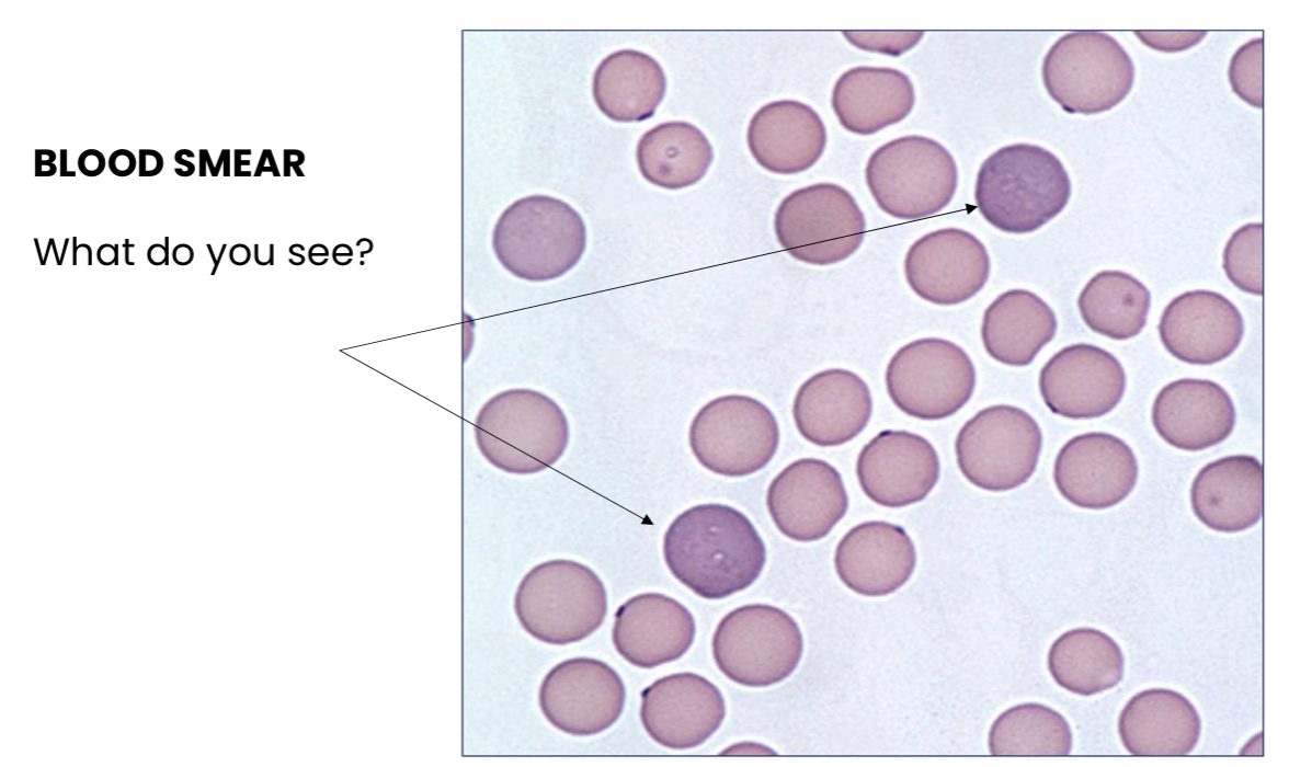 <p>What do you see?</p>