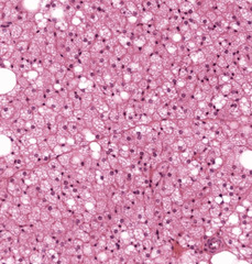 <p>What type of cells are majority on this image?</p>