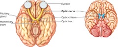 <p>Nerve that senses vision.</p>