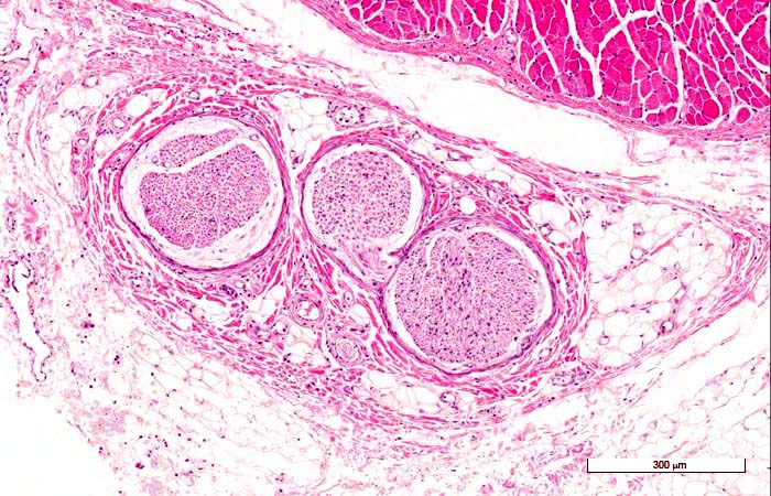 <p>Identifica la plaquita</p>