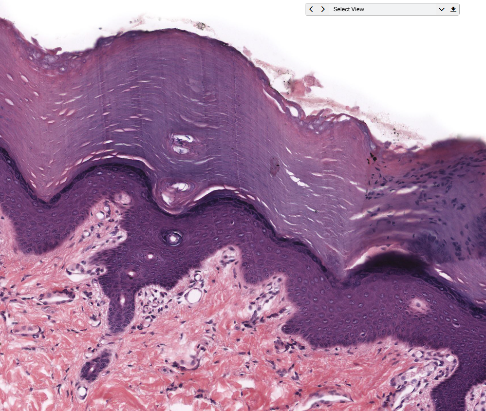 <p>Layers of the epidermis</p>