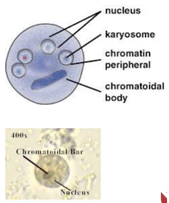 <p>Entamoeba histolytica: Cyst</p>