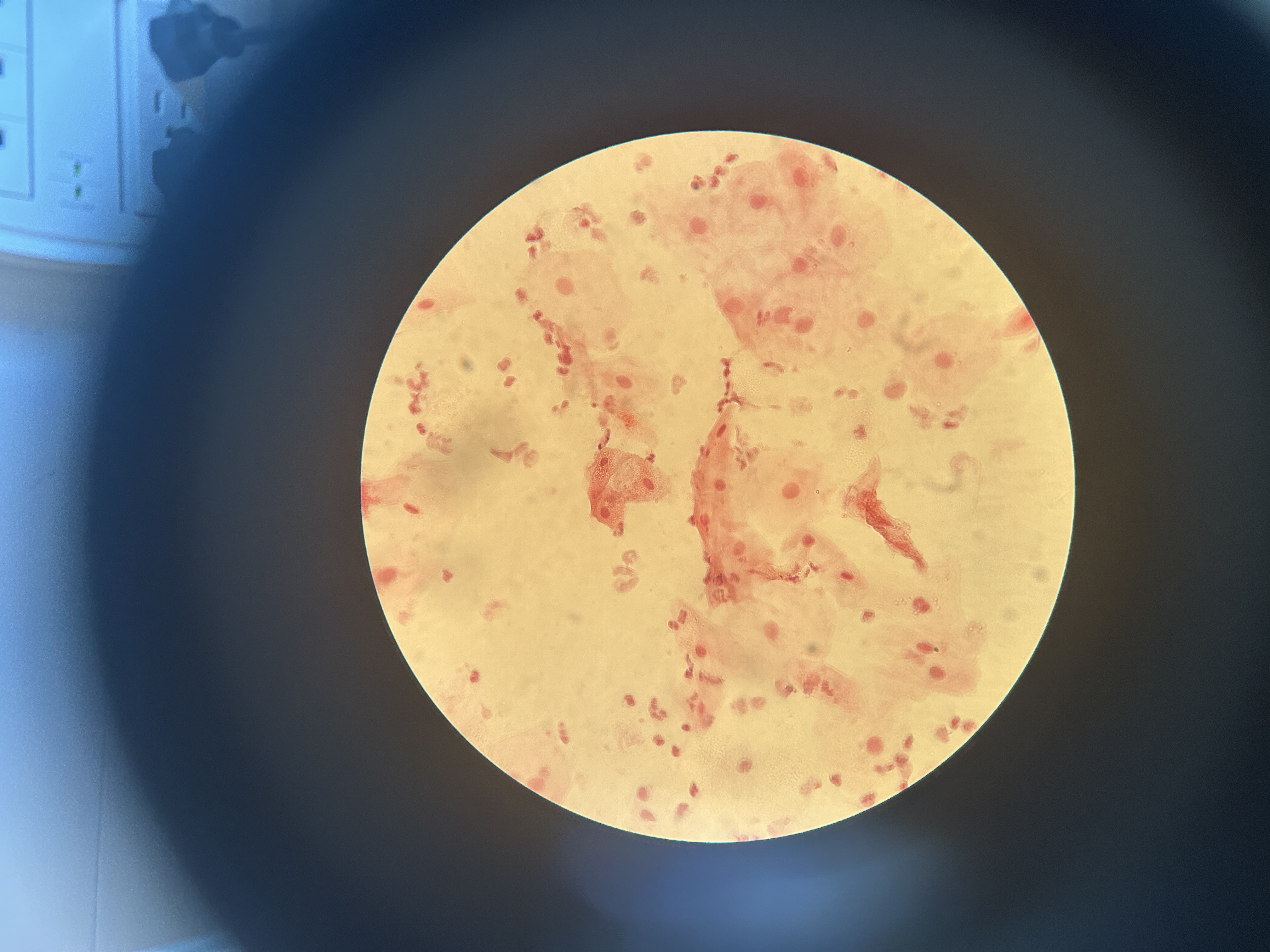 <p>Is this a Prokaryotic or Eukaryotic Cell</p>