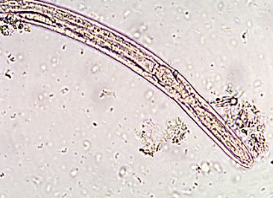 <p><span style="background-color: rgba(0, 0, 0, 0); line-height: 19.7625px;">What is the species in this photo? It is from a fresh stool. </span></p>