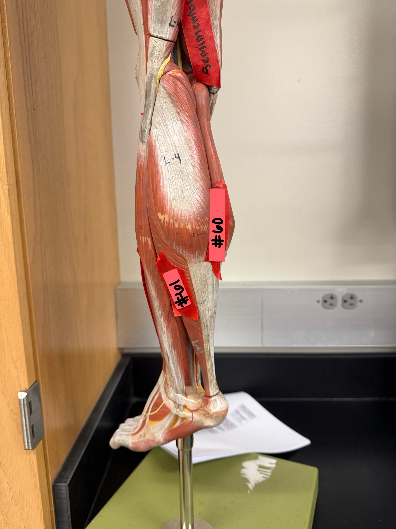 <p>What muscle is located at #61?</p>