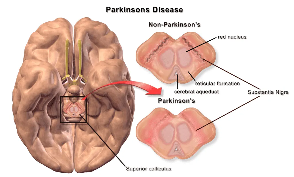 <p>Motor control (extrapyramidal system)</p><p>dopaminergic neurons affected in Parkinson disease</p>
