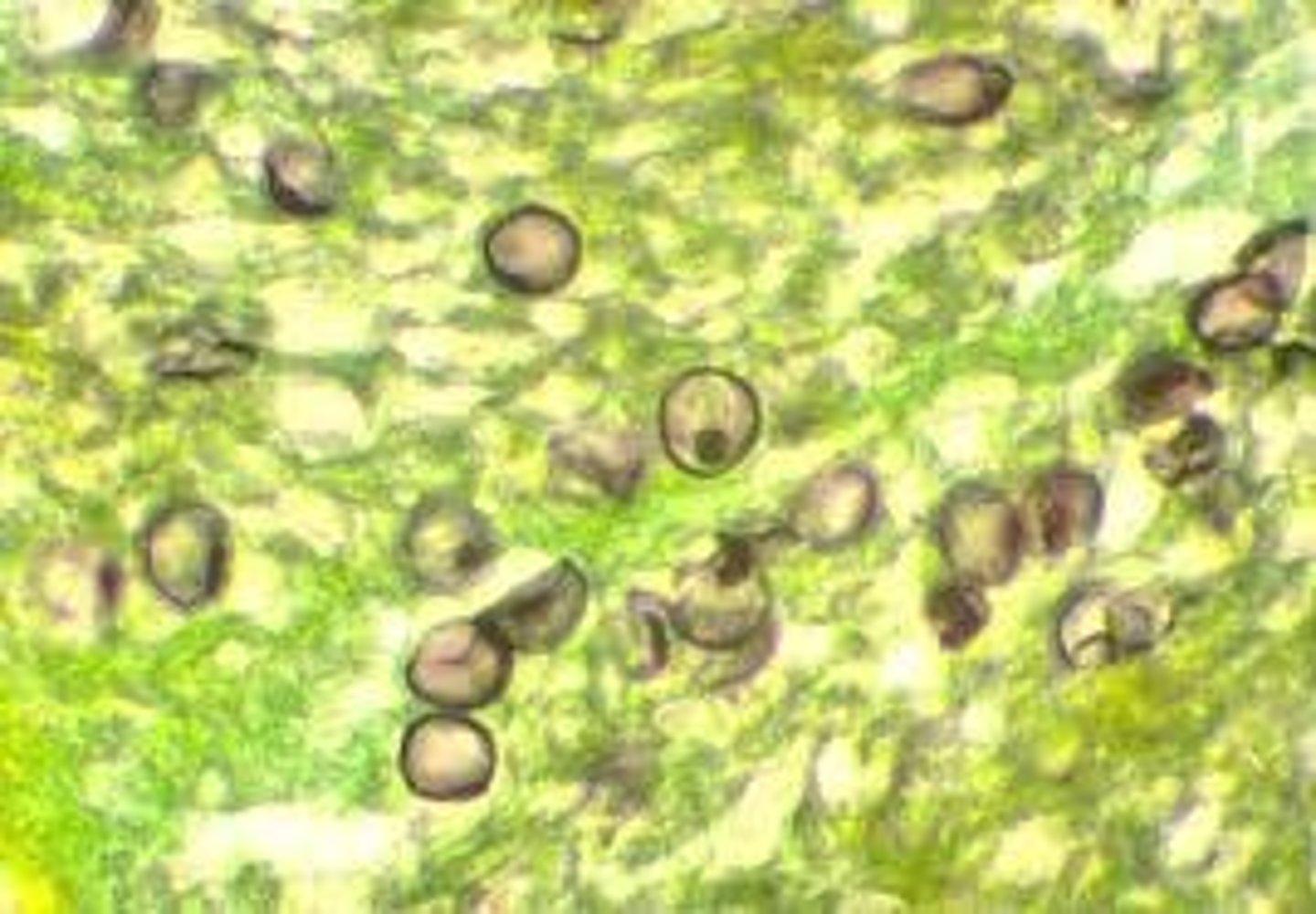 <p>Troph, precyst, cyst</p>