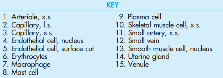 <p>Venule, l.s., Connective Tissue, <strong>Epiglottis</strong></p>