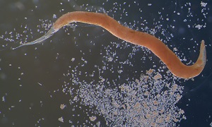 <p>Enterobius vermicularis Egg</p>