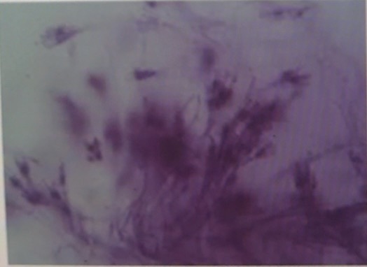 term image