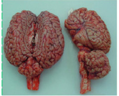 <p>Which of these is normal? What does the abnormal show?</p>