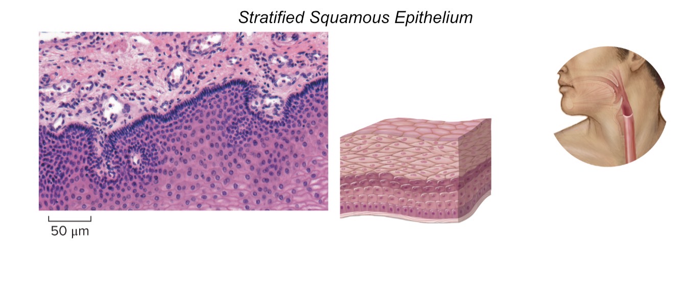 <ul><li><p><em>Characteristic Feature: </em>epithelial cells; several layers thick</p></li><li><p><em>Cell shape/Characteristics</em>: upper layer, squamous; middle layer, cuboidal; basal (bottom) layer, columnar</p></li><li><p><em>Function:</em> tough layers of cells providing protection to underlying tissues</p></li><li><p><em>Location: </em>outer layer of skin and lining of mouth</p></li></ul><p></p>