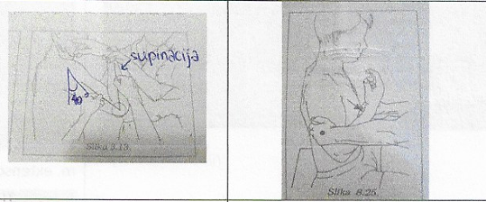 <p>fleksija komolca (pronacija)</p>