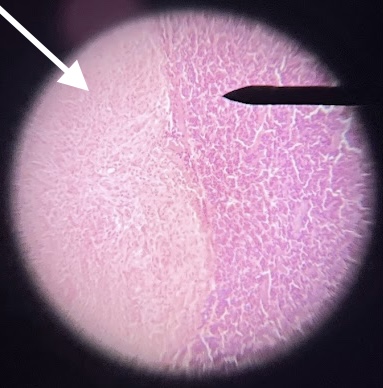 <p><span>The structure with the white arrows depicts which part of the pituitary</span></p>