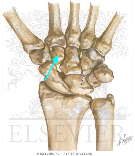 term image