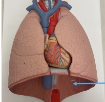 <p>name the part</p>