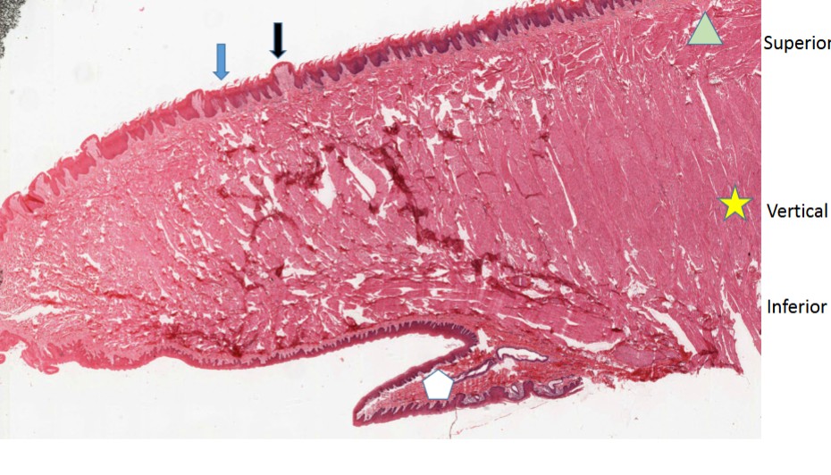 <p>Tongue Overview</p>