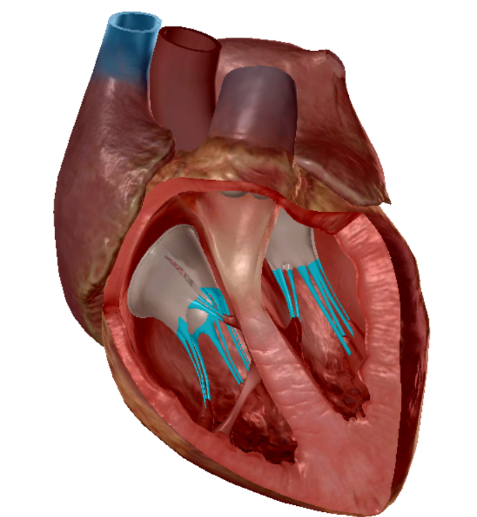 term image