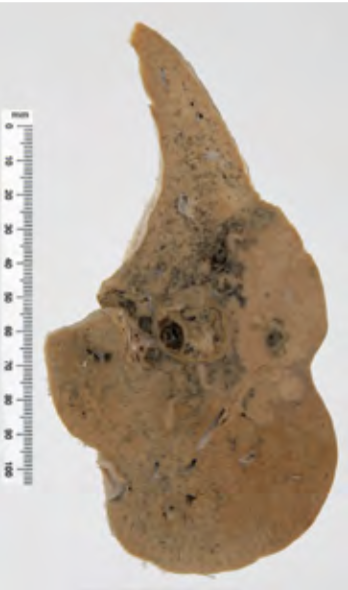 <p>Identify the POT</p>