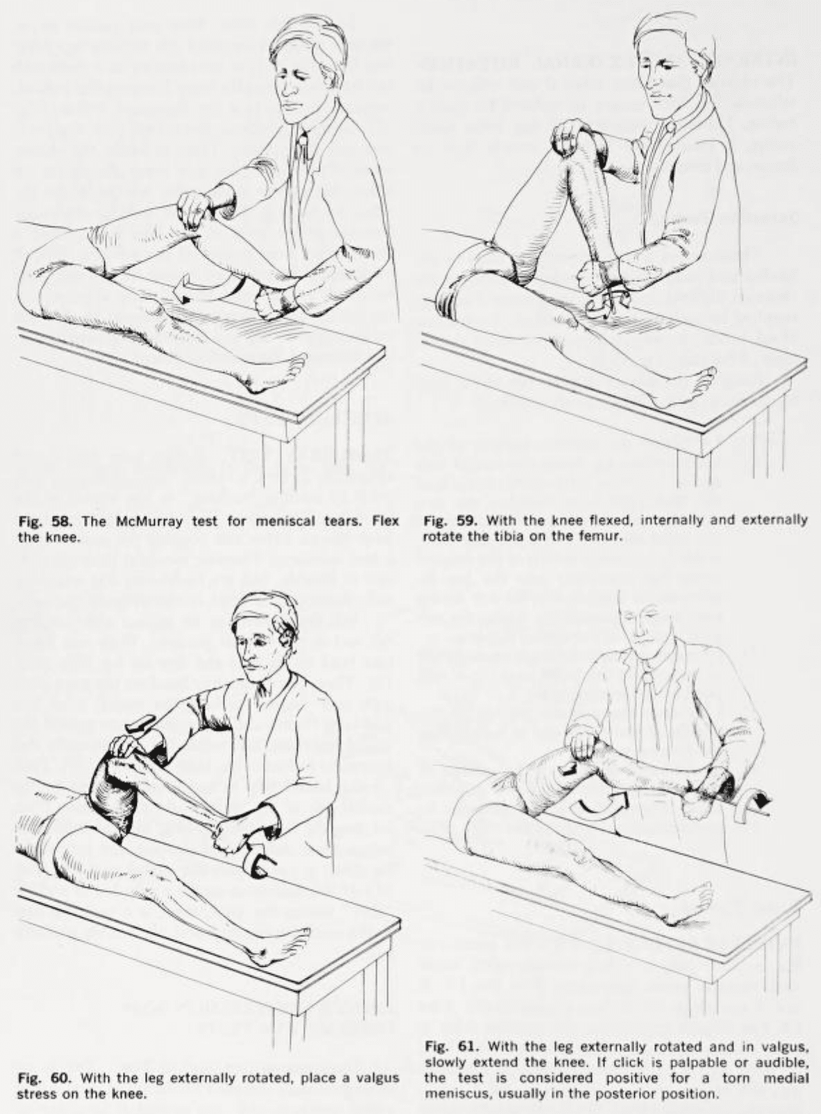 <p>McMurray test </p>