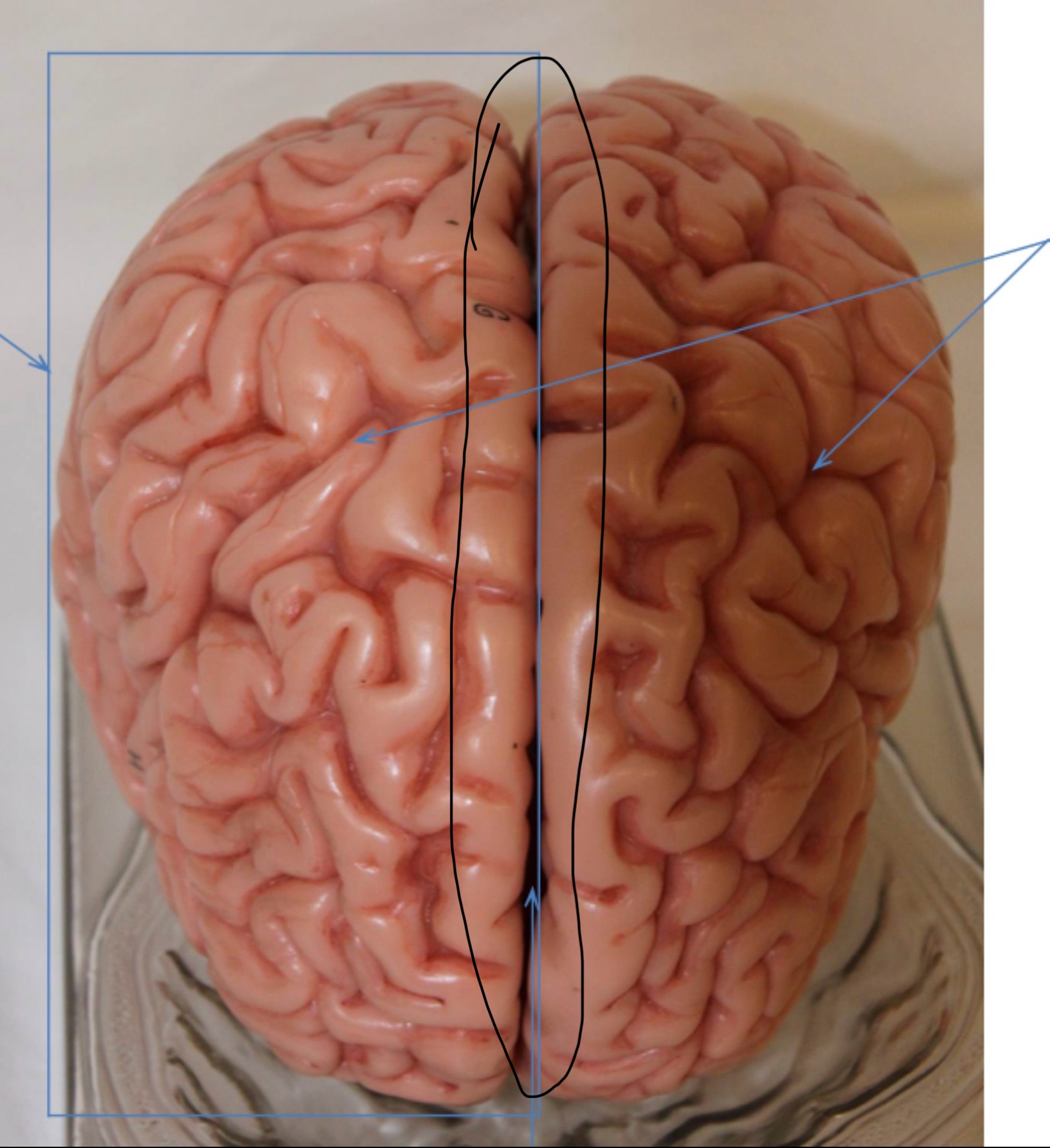 <p>Identify the circled area?</p>