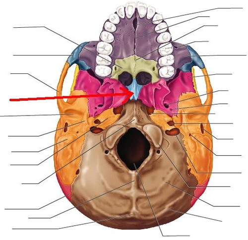 term image