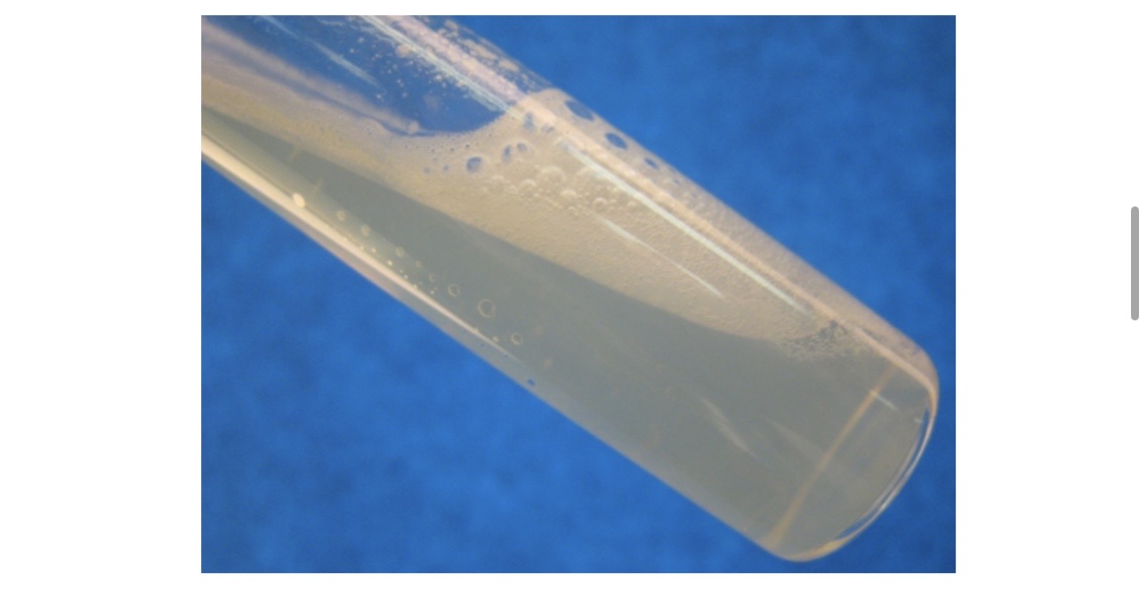 <p>A. What test is shown here? </p><p>B. Is it a positive or negative result? And what did it determine? </p>