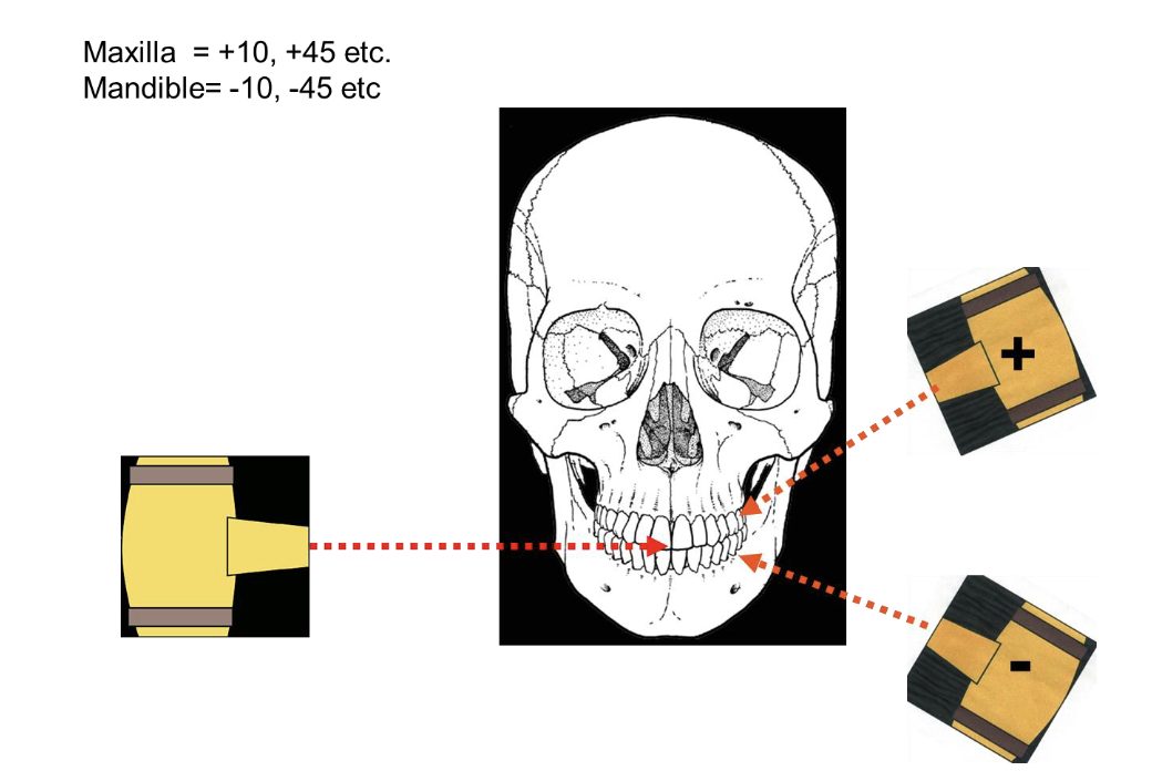 <p><strong><u>-Horizontal beam alignment:</u></strong> same as paralleling technique.</p><p><strong><u>-Vertical beam alignment: </u></strong></p><ul><li><p>Central ray is directed perpendicular to imaginary line formed by the long axis of the tooth and film/receptor </p></li></ul><p></p>