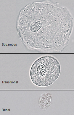 <p>Large flat cells with single nucleus and large cytoplasm. edges can fold/curve making for unusual transformations</p>