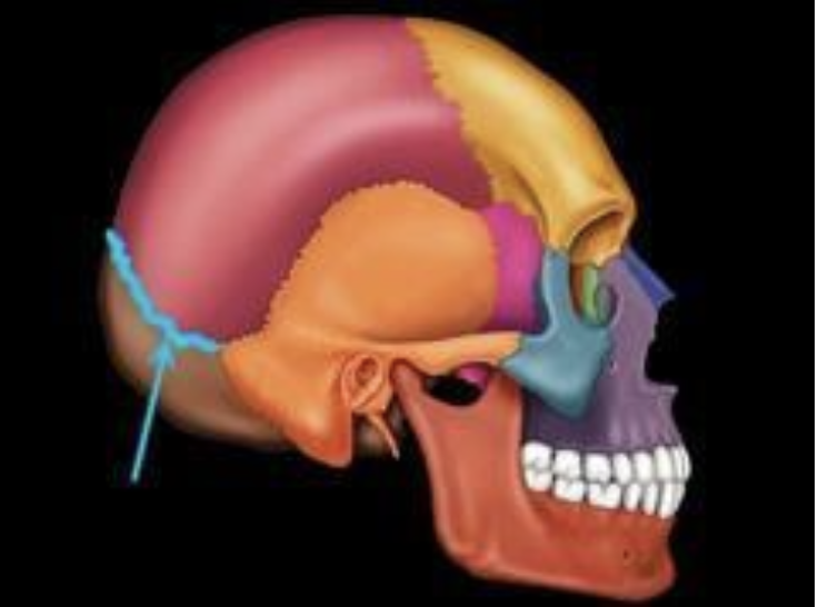 <p>Which suture is shown in the photo?</p><p>A. Metopic </p><p>B. Coronal </p><p>C. Sagittal </p><p>D. Lamboidal </p>