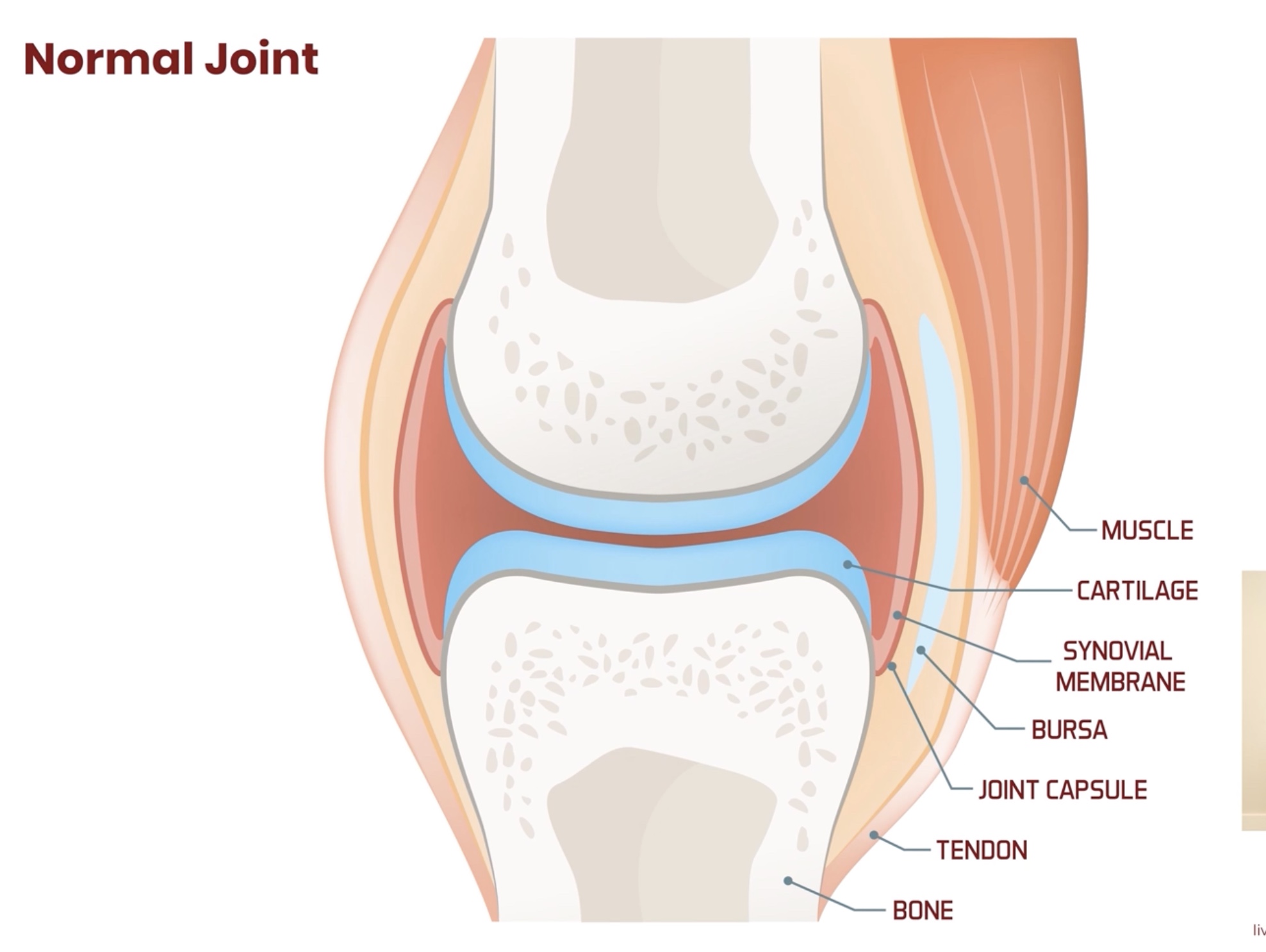 <p><em>Bursa</em></p>